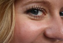 Wrinkles under eyes when smiling