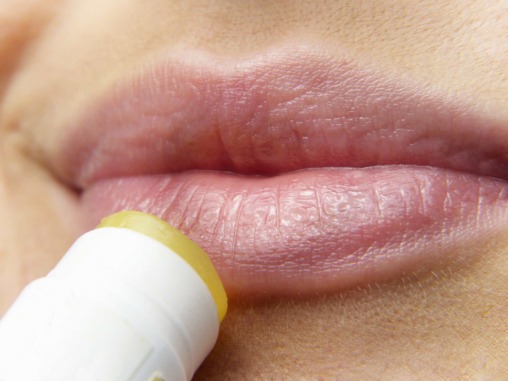 HPV White Spots on Lips, Symptoms, Causes, and Treatment